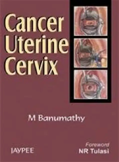 Cancer Uterine Cervix by Banumathy