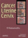 Cancer Uterine Cervix by Banumathy