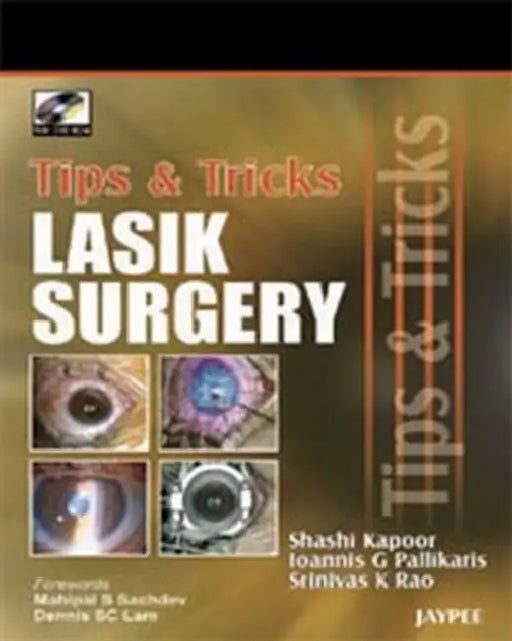 Tips & Tricks Lasik Surgery With Dvd Rom by Shashi Kapoor