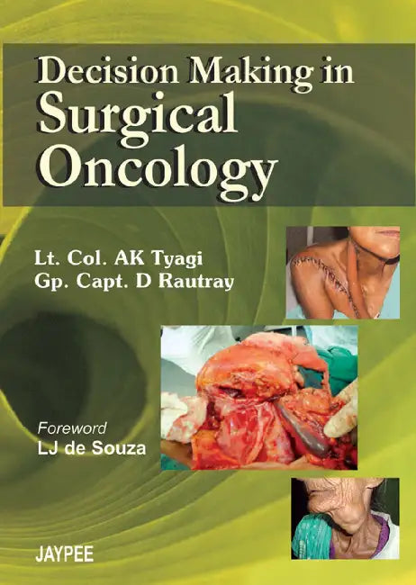 Decision Making In Surgical Oncology by Ak Tyagi