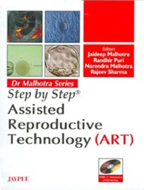 Step By Step Assisted Reproductive Technology (Art) With 2 Int.Dvd-Roms Dr.Malhotra Series by Jaideep Malhotra