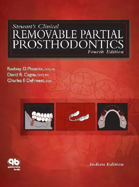 Stewarts Clinical Removable Partial Prosthodontics 4e by Phoenix R.D.