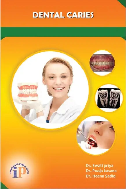 Dental Caries by Dr. Swati Priya