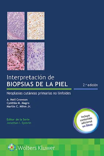 Interpretación de Biopsias de la Piel: Neoplasias Cutáneas Primarias No Linfoides by A. Neil Crowson, Cynthia M. Magro, Martin C. Mihm