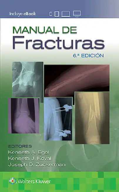 Manual de Fracturas by Kenneth Egol