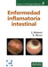 Enfermedad inflamatoria intestinal by Elena Ricart Gómez