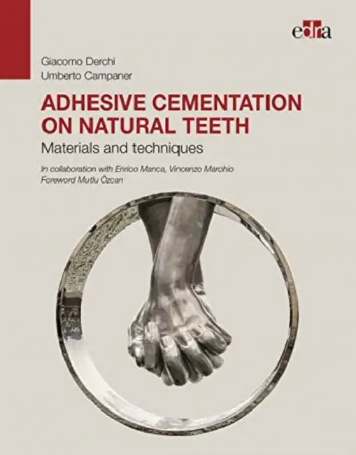 Adhesive Cementation on Natural Teeth. Materials and Techniques by Giacomo Derchi, Umberto Campaner