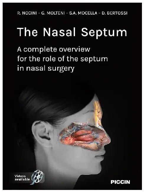 The Nasal Septum A Complete Overview For The Role of The Septum In Nasal Surgery by Nocini R.
