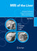 MRI of the Liver: Imaging Techniques, Contrast Enhancement, Differential Diagnosis by Günther Schneider