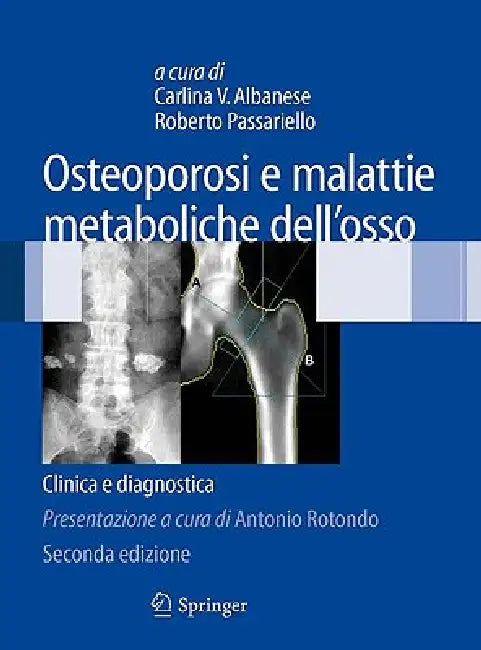 Osteoporosi E Malattie Metaboliche Dell'osso: Clinica E Diagnostica by Carlina V. Albanese, Roberto Passariello