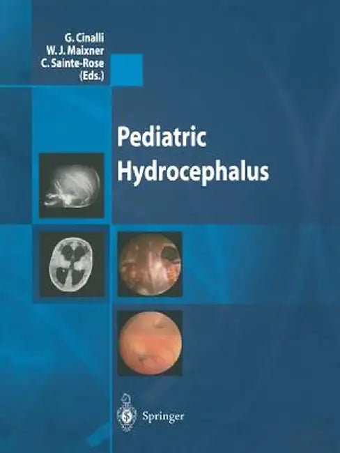 Pediatric Hydrocephalus by G. Cinalli