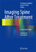 Imaging Spine After Treatment: A Case-Based Atlas by Tommaso Scarabino