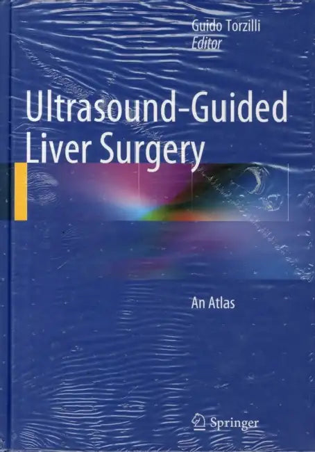 Ultrasound-Guided Liver Surgery: An Atlas by Guido Torzilli