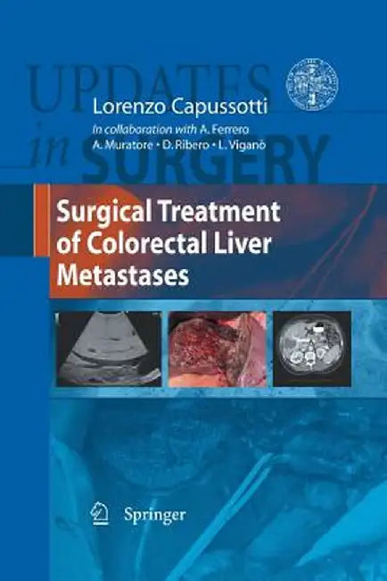 Surgical Treatment of Colorectal Liver Metastases by Lorenzo Capussotti