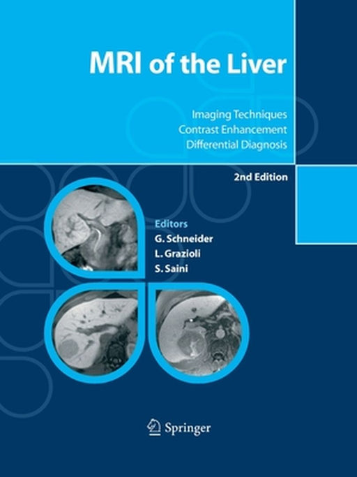 MRI of the Liver: Imaging Techniques, Contrast Enhancement, Differential Diagnosis by Günther Schneider