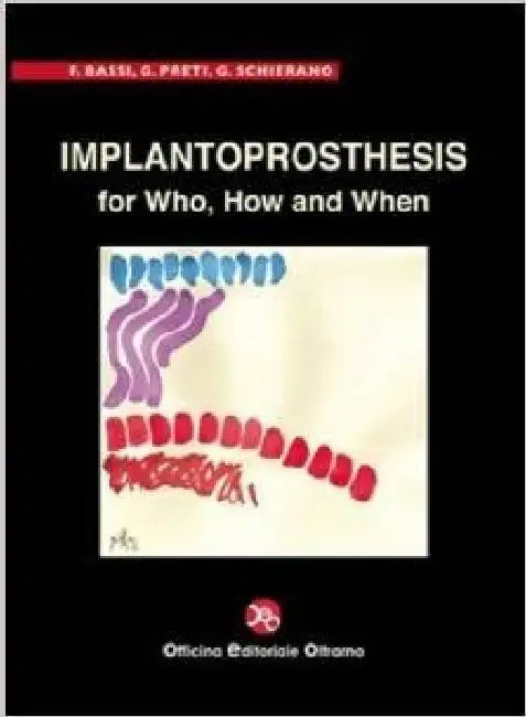 Implantoprosthesis for Who, How and When by Bassi