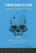 Trepanation by Robert Arnott