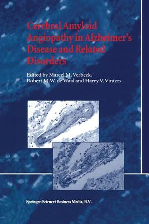 Cerebral Amyloid Angiopathy in Alzheimer's Disease and Related Disorders by M. M. Verbeek