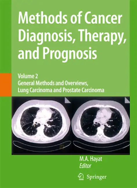 Methods of Cancer Diagnosis, Therapy and Prognosis: General Methods and Overviews, Lung Carcinoma and Prostate Carcinoma by M. A. Hayat