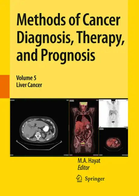Methods of Cancer Diagnosis, Therapy, and Prognosis: Liver Cancer by M. A. Hayat
