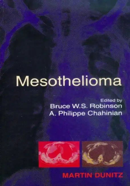 Mesothelioma by Bruce W. S. Robinson