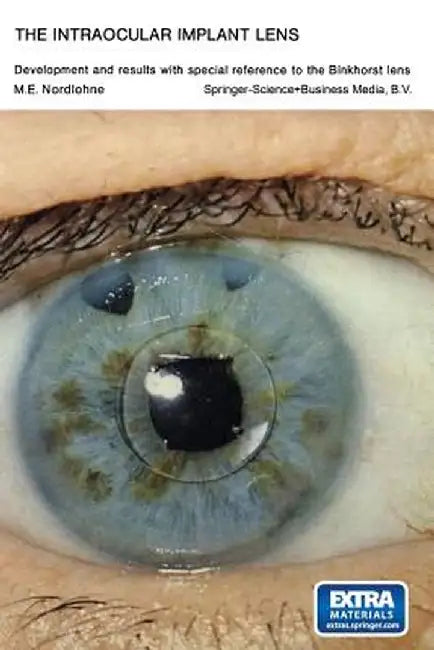The Intraocular Implant Lens Development and Results with Special Reference to the Binkhorst Lens: Proefschrift by Marcel Eugène Nordlohne