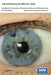 The Intraocular Implant Lens Development and Results with Special Reference to the Binkhorst Lens: Proefschrift by Marcel Eugène Nordlohne