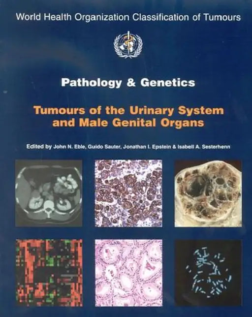 Pathology & Genetics Tumours Of The Urinary System And Male Genital Organs Who Classification Of Tum by Eble