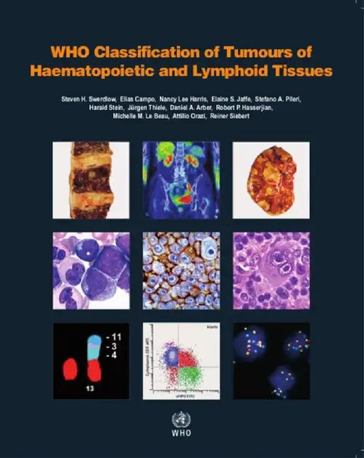 WHO Classification of Tumours of Haematopoietic and Lymphoid Tissues by S. Swerdlow