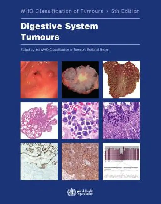 Digestive System Tumours: Who Classification of Tumours by Who Classification of Tumours Editorial