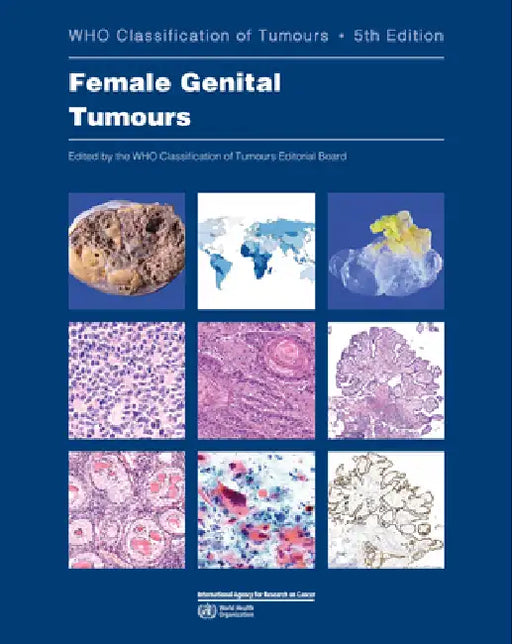Female Genital Tumours: Who Classification of Tumours by Who Classification of Tumours Editorial