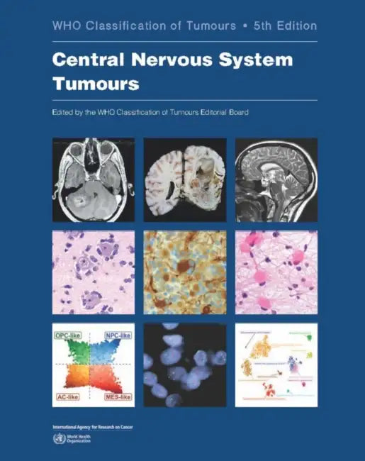 Central Nervous System Tumours: Who Classification of Tumours by Who Classification of Tumours Editorial