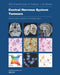 Central Nervous System Tumours: Who Classification of Tumours by Who Classification of Tumours Editorial