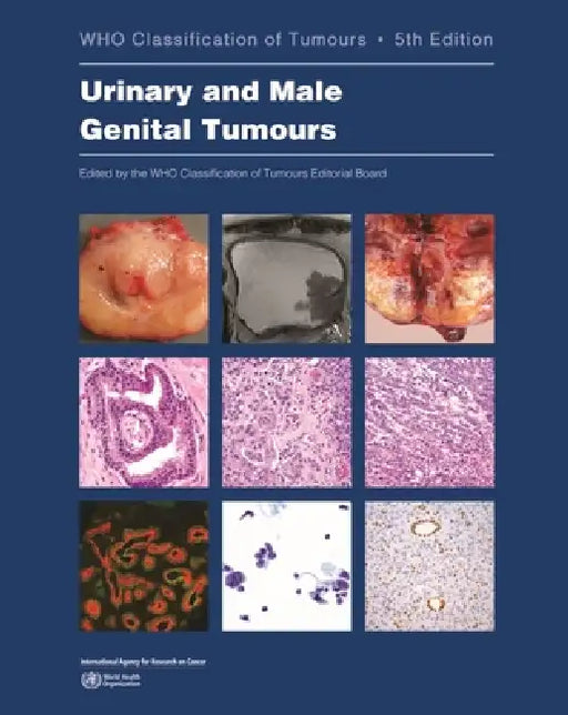 Urinary and Male Genital Tumours by Who Classification of Tumours Editorial