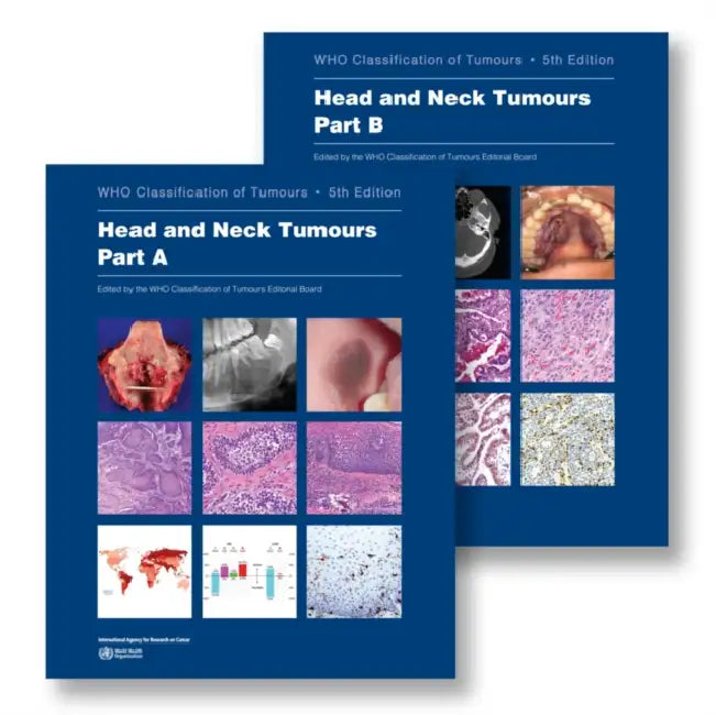 Head and Neck Tumours: Who Classification of Tumours by Who Classification of Tumours Editorial