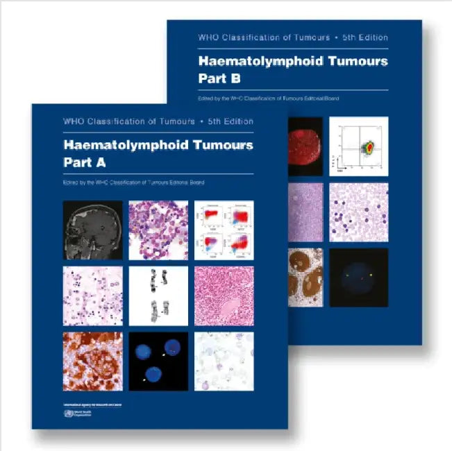 Haematolymphoid Tumours: Who Classification of Tumours by Who Classification of Tumours Editorial