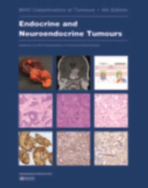 Endocrine and Neuroendocrine Tumours: Who Classification of Tumours by Who Classification of Tumours Editorial