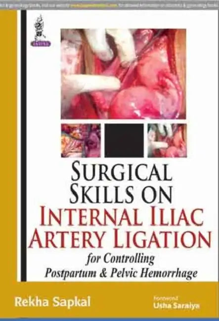 Surgical Skills On Internal Iliac Artery Ligation:For Controlling Postpartum & Pelvic Hemorrhage by Rekha Sapkal