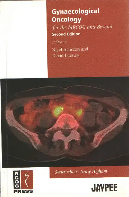 Gynaecological Oncology For The Mrcog And Beyond by Acheson Nigel