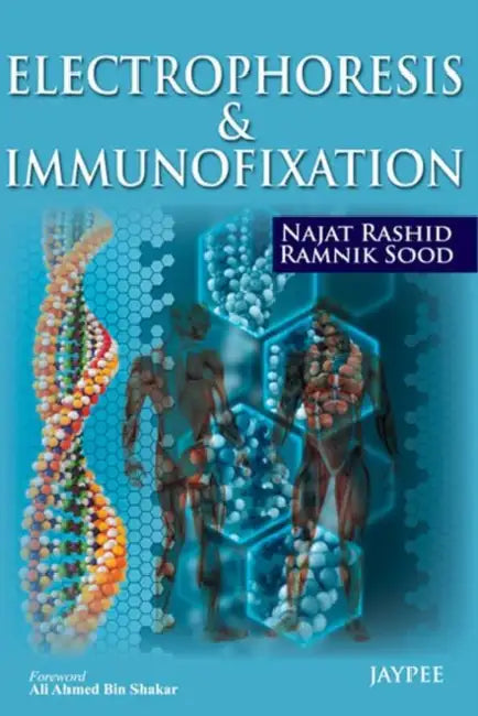 Electrophoresis & Immunofixation by Najat Rashid