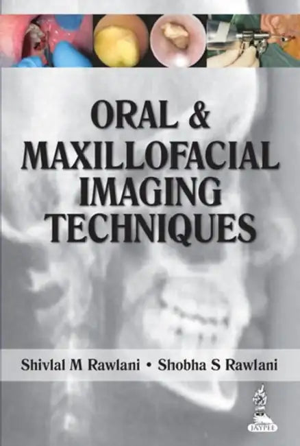 Oral & Maxillofacial Imaging Techniques by Shivlal M Rawlani