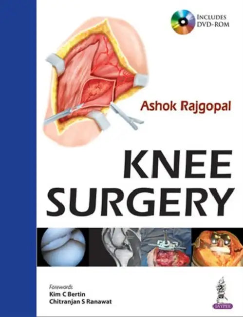 Knee Surgery Includes Dvd-Rom by Ashok Rajgopal
