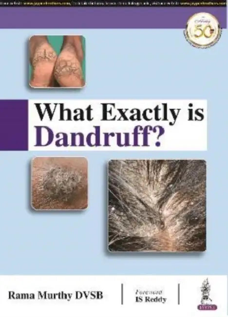 What Exactly is Dandruff? by Rama Murthy DVSB