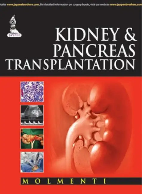 Kidney & Pancreas Transplantation by Ernesto Pompeo Molmenti