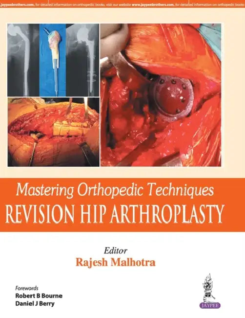 Mastering Orthopedic Techniques Revision Hip Arthroplasty by Rajesh Malhotra