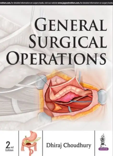General Surgical Operations by Dhiraj Choudhury