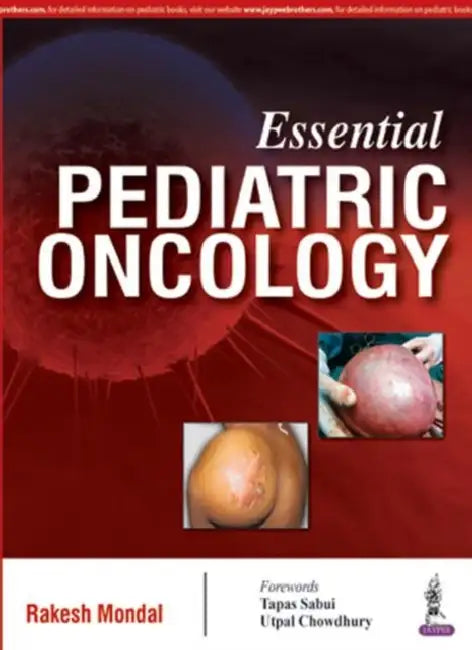 Essential Pediatric Oncology by Rakesh Mondal