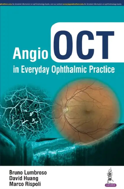 Angio Oct In Everyday Ophthalmic Practice by Bruno Lumbroso