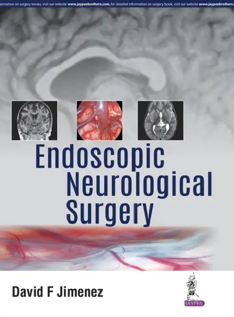Endoscopic Neurological Surgery by David F Jimenez