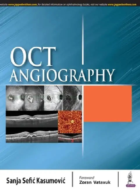 Oct Angiography by Sefic Sanja Kasumovic